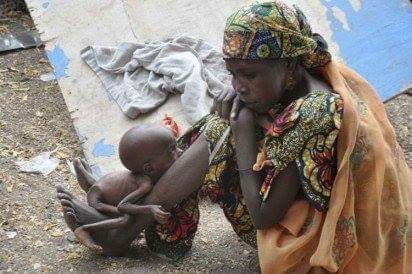 Nasarawa: Acute malnutrition kills 20 Children, as NPHCDA supplies expired food supplements